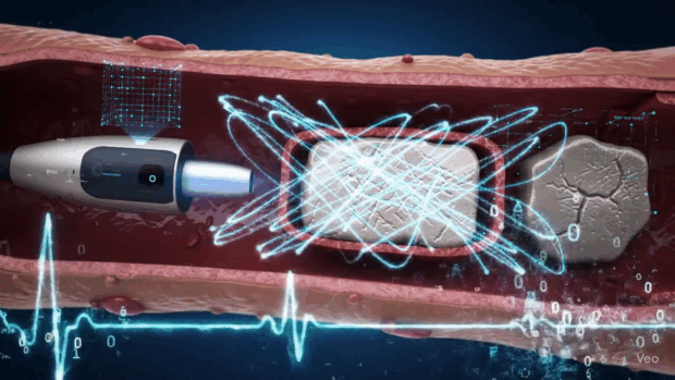 AI στην Καρδιολογία Νέες Διαγνώσεις με OCT και ECG